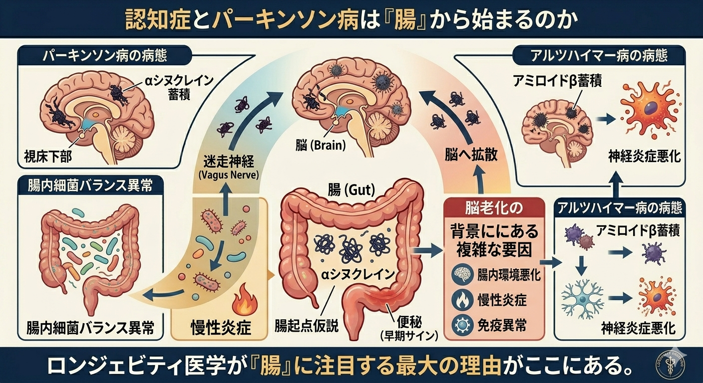 認知症とパーキンソン病は「腸」から始まるのか