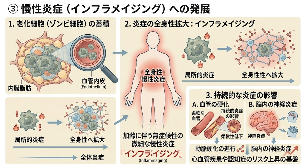 ③ 慢性炎症（インフラメイジング）への発展