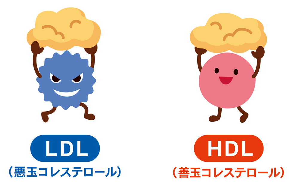 なぜコレステロールの「悪玉・善玉」という古いイメージギャップが世の中に残り続けるのか